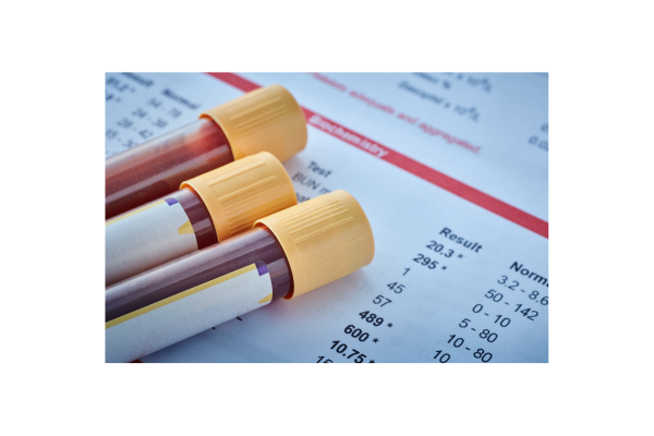 Blood and Breath Test Accuracy In Colorado